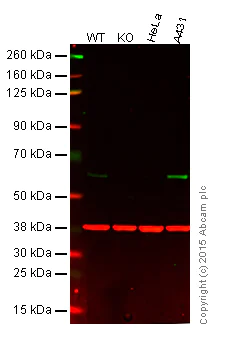 Western blot - Anti-Src antibody [EGTR103] - BSA and Azide free (AB222221)