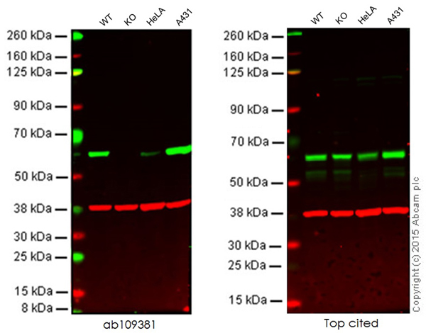 Western blot - Anti-Src antibody [EPR5496] (AB109381), expandable thumbnail