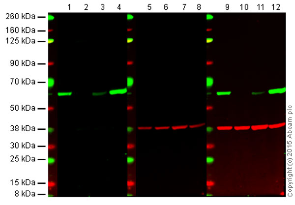 Western blot - Anti-Src antibody [EPR5496] (AB109381), expandable thumbnail