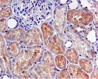 Immunohistochemistry (Formalin/PFA-fixed paraffin-embedded sections) - Anti-Src antibody [EPR5496] - BSA and Azide free (AB222220)