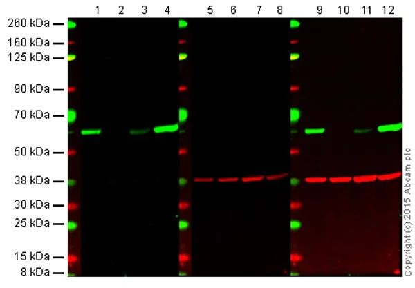 Western blot - Anti-Src antibody [EPR5496] - BSA and Azide free (AB222220)