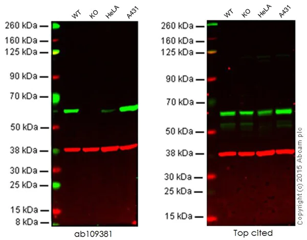 Western blot - Anti-Src antibody [EPR5496] - BSA and Azide free (AB222220)