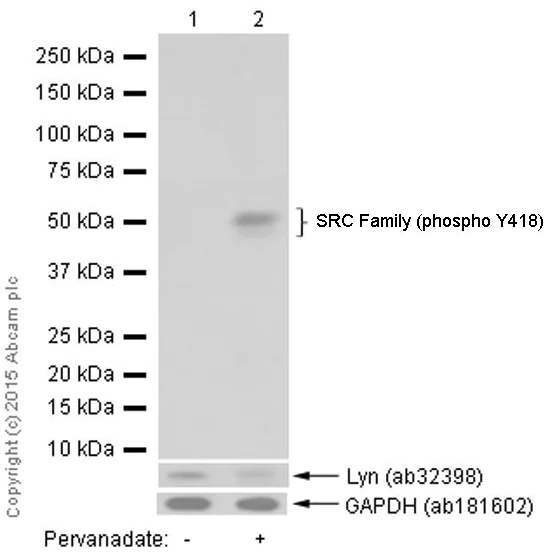 おまとめ【aph240】【aph63】【q1041】【cre6】 Anti-SRC Family (phospho Y418) antibody [EP503Y] (ab40660