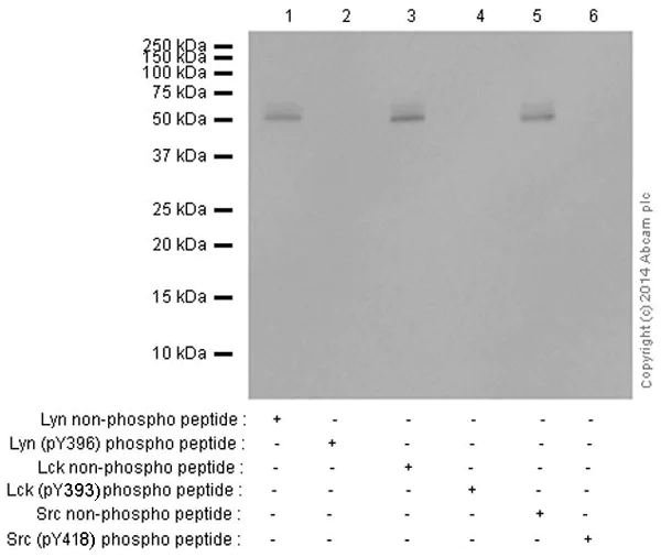 Western blot - Anti-SRC Family (phospho Y418) antibody [EP503Y] (AB40660)