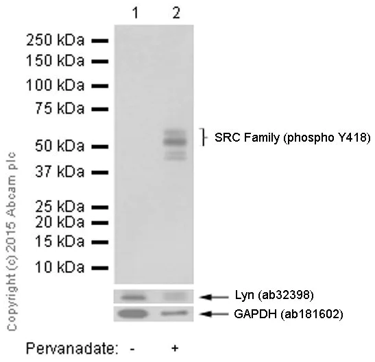 Western blot - Anti-SRC Family (phospho Y418) antibody [EP503Y] (AB40660)
