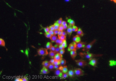 Immunocytochemistry/ Immunofluorescence - Anti-SRC Family (phospho Y418) antibody [EP503Y] - BSA and Azide free (AB239824), expandable thumbnail