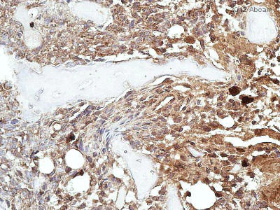 Immunohistochemistry (Formalin/PFA-fixed paraffin-embedded sections) - Anti-Src (phospho S75) antibody (AB79308)