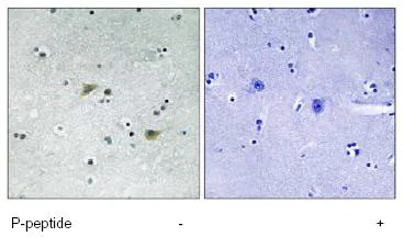 Immunohistochemistry (Formalin/PFA-fixed paraffin-embedded sections) - Anti-Src (phospho S75) antibody (AB79308)