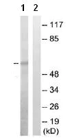 Western blot - Anti-Src (phospho S75) antibody (AB79308)
