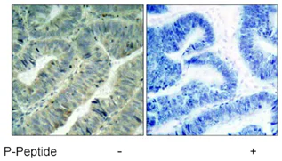 Immunohistochemistry (Formalin/PFA-fixed paraffin-embedded sections) - Anti-Src (phospho Y419) antibody (AB47411)