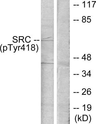 Western blot - Anti-Src (phospho Y419) antibody (AB47411)