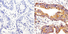 Immunohistochemistry (Formalin/PFA-fixed paraffin-embedded sections) - Anti-Src (phospho Y419) antibody (AB4816)