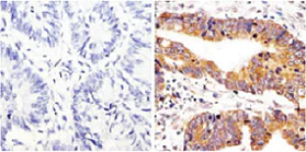 Immunohistochemistry (Formalin/PFA-fixed paraffin-embedded sections) - Anti-Src (phospho Y419) antibody (AB4816)