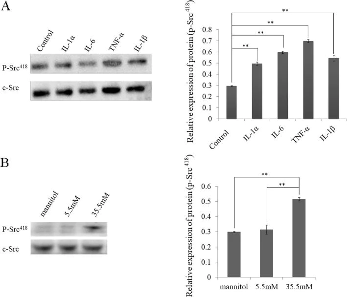 Western blot - Anti-Src (phospho Y419) antibody [EPR6239(2)] (AB133460)