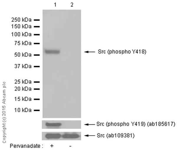 Western blot - Anti-Src (phospho Y419) antibody [EPR6239(2)] - BSA and Azide free (AB248506)