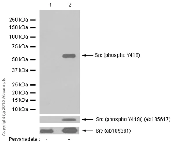 Western blot - Anti-Src (phospho Y419) antibody [EPR6239(2)] - BSA and Azide free (AB248506)