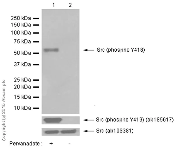 Western blot - Anti-Src (phospho Y419) antibody [EPR6239(2)] - BSA and Azide free (AB248506)