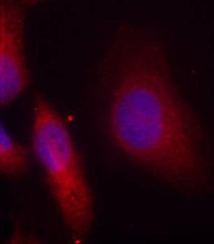 Immunocytochemistry/ Immunofluorescence - Anti-Src (phospho Y529) antibody (AB194739), expandable thumbnail