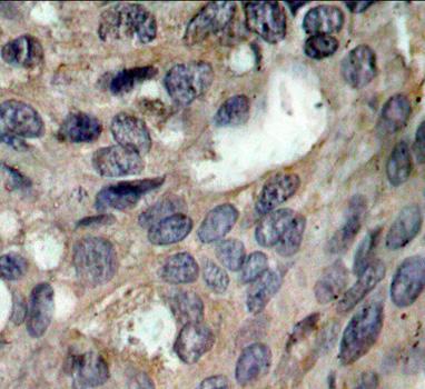 Immunohistochemistry (Formalin/PFA-fixed paraffin-embedded sections) - Anti-Src (phospho Y529) antibody (AB194739), expandable thumbnail