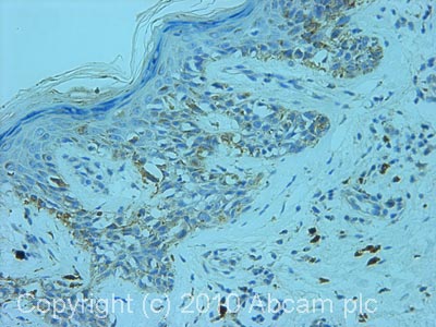 Immunohistochemistry (Formalin/PFA-fixed paraffin-embedded sections) - Anti-SRC3 antibody (AB2831)