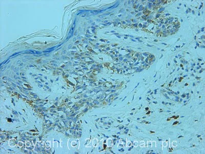 Immunohistochemistry (Formalin/PFA-fixed paraffin-embedded sections) - Anti-SRC3 antibody (AB2831)