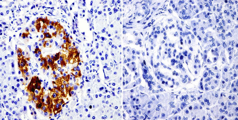 Immunohistochemistry (Formalin/PFA-fixed paraffin-embedded sections) - Anti-SRC3 antibody [AX15.3] - ChIP Grade (AB2782)