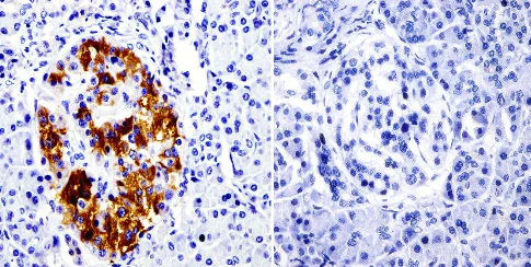 Immunohistochemistry (Formalin/PFA-fixed paraffin-embedded sections) - Anti-SRC3 antibody [AX15.3] - ChIP Grade (AB2782)