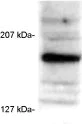 Western blot - Anti-SRC3 antibody [AX15.3] - ChIP Grade (AB2782)