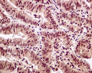 Immunohistochemistry (Formalin/PFA-fixed paraffin-embedded sections) - Anti-SRC3 antibody [EPR4374(3)] (AB133611), expandable thumbnail