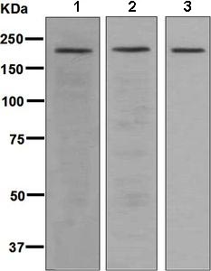 Western blot - Anti-SRC3 antibody [EPR4374(3)] (AB133611), expandable thumbnail