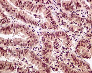 Immunohistochemistry (Formalin/PFA-fixed paraffin-embedded sections) - Anti-SRC3 antibody [EPR4374(3)] - BSA and Azide free (AB243600)
