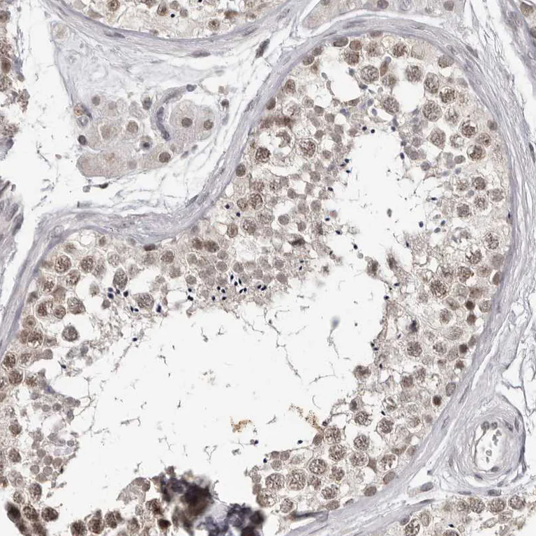 Immunohistochemistry (Formalin/PFA-fixed paraffin-embedded sections) - Anti-SRCAP Antibody (AB327216)