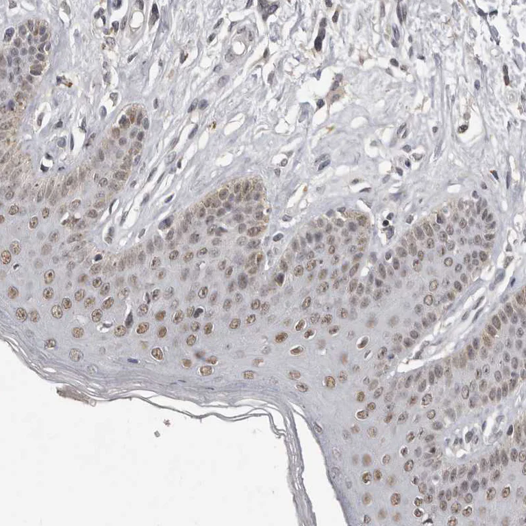 Immunohistochemistry (Formalin/PFA-fixed paraffin-embedded sections) - Anti-SRCAP Antibody (AB327216)