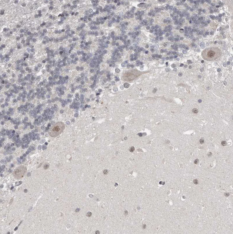 Immunohistochemistry (Formalin/PFA-fixed paraffin-embedded sections) - Anti-SRCAP Antibody (AB327216)