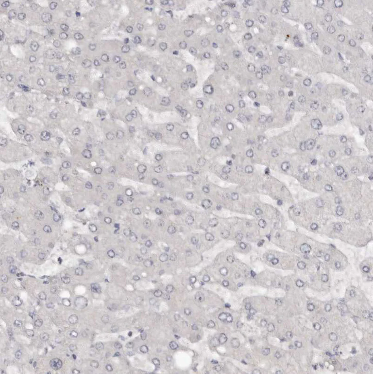 Immunohistochemistry (Formalin/PFA-fixed paraffin-embedded sections) - Anti-SRCAP Antibody (AB327216)