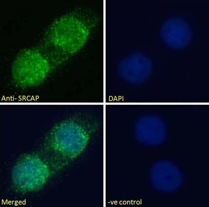 Immunocytochemistry/ Immunofluorescence - Anti-SRCAP antibody (AB99408)