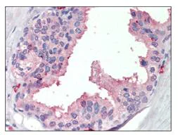 Immunohistochemistry (Formalin/PFA-fixed paraffin-embedded sections) - Anti-SRD5A1 antibody (AB110123)