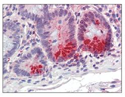 Immunohistochemistry (Formalin/PFA-fixed paraffin-embedded sections) - Anti-SRD5A1 antibody (AB110123)