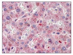 Immunohistochemistry (Formalin/PFA-fixed paraffin-embedded sections) - Anti-SRD5A1 antibody (AB110123)