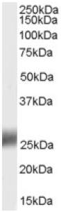 Western blot - Anti-SRD5A2 antibody (AB27469)