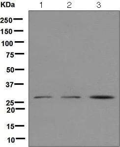 Western blot - Anti-SRD5A2 antibody [EPR6281(B)] (AB124877)