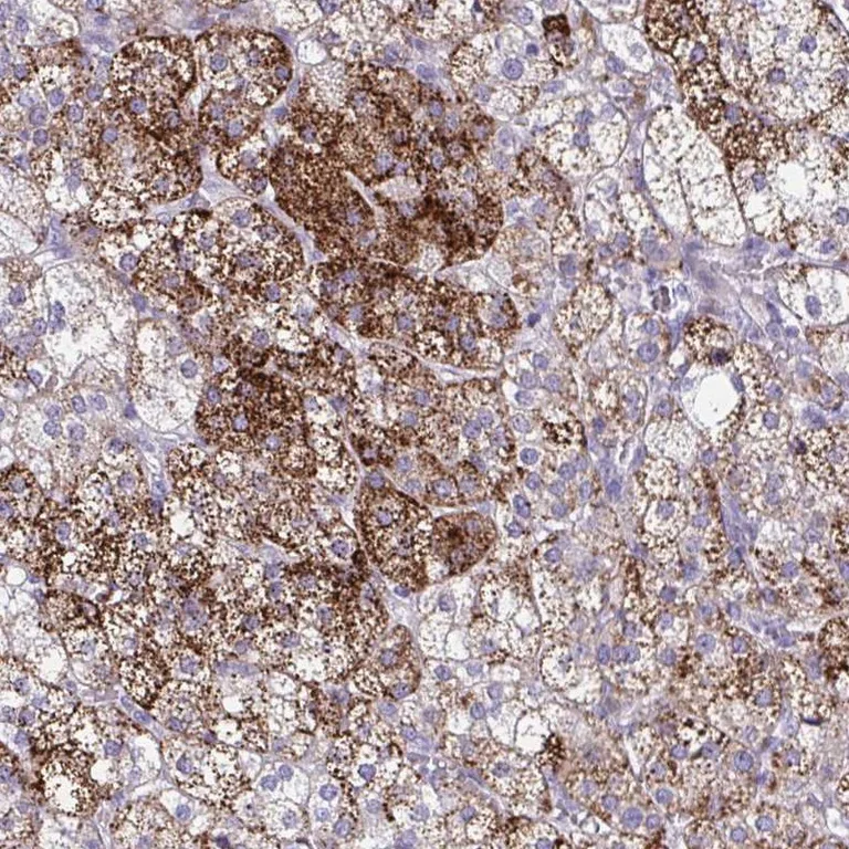 Immunohistochemistry (Formalin/PFA-fixed paraffin-embedded sections) - Anti-SREBF1 Antibody (AB327227)