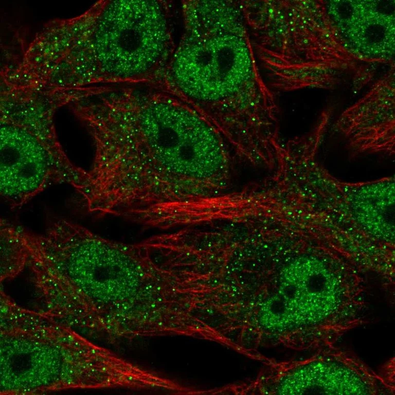 Immunocytochemistry/ Immunofluorescence - Anti-SREBF2 Antibody (AB327222)