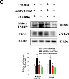 Western blot - Anti-SREBP1 antibody [2A4] (AB3259)