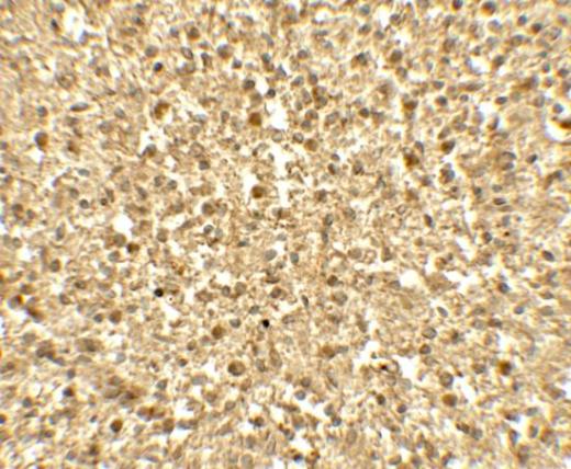 Immunohistochemistry (Formalin/PFA-fixed paraffin-embedded sections) - Anti-SREBP1 antibody (AB191857)