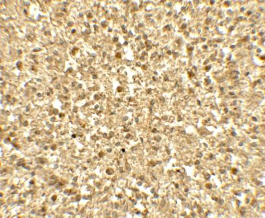 Immunohistochemistry (Formalin/PFA-fixed paraffin-embedded sections) - Anti-SREBP1 antibody (AB191857)