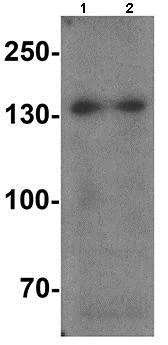 Western blot - Anti-SREBP1 antibody (AB191857)