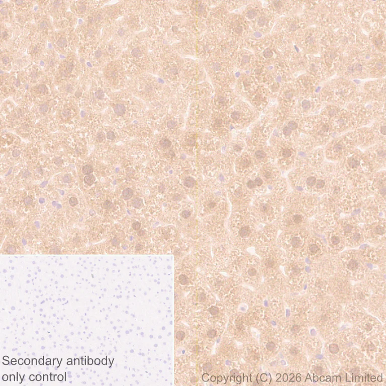 Immunohistochemistry (Formalin/PFA-fixed paraffin-embedded sections) - Anti-SREBP1 antibody [EPR30539-645] (AB326106)