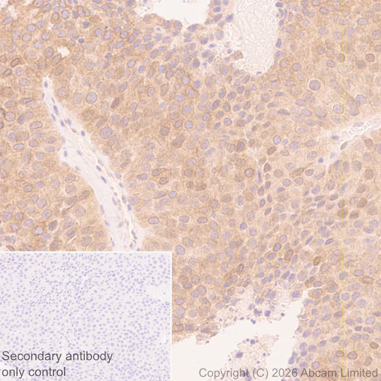 Immunohistochemistry (Formalin/PFA-fixed paraffin-embedded sections) - Anti-SREBP1 antibody [EPR30539-645] (AB326106)