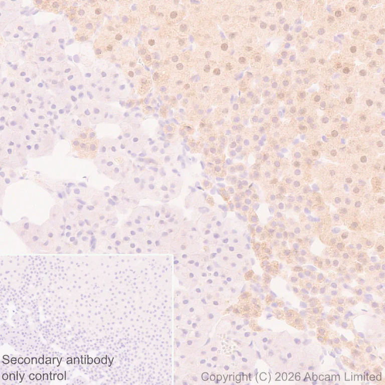 Immunohistochemistry (Formalin/PFA-fixed paraffin-embedded sections) - Anti-SREBP1 antibody [EPR30539-645] (AB326106)